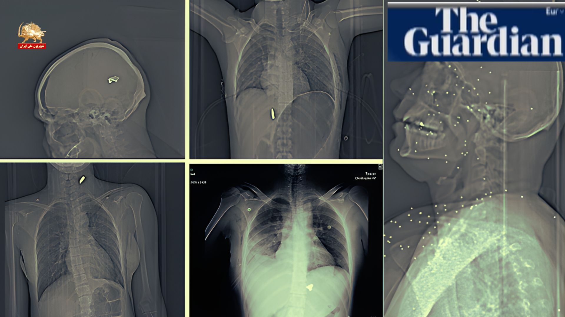 گزارش گاردین از شلیک به معترضین